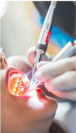 Scaling and polishing procedure at Tooth Zone